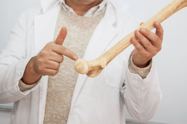 medico segurando um osso